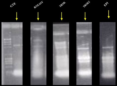 Gcat Protocols Rna Isloation Methods