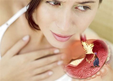 14 рецептов от изжоги | Травник