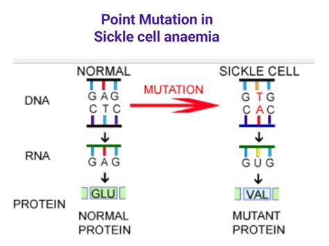 Sickle Cell Anaemia Is