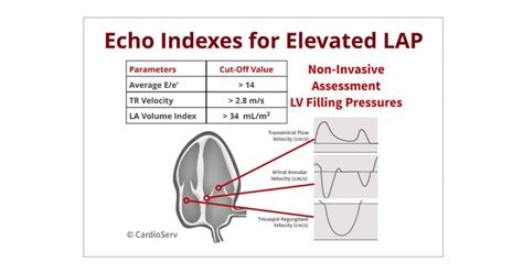 This week we will discuss specific echo parameters that determine left ...