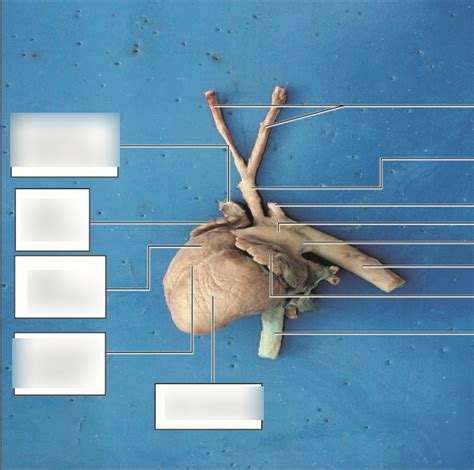 Thoracic Veins Arteries Lab Manual Diagram Quizlet