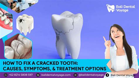 fix cracked tooth  symptoms treatments