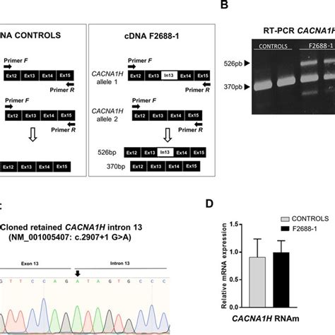 Splice Donor Site Variant In Intron Of The Cacna H Gene In Patient