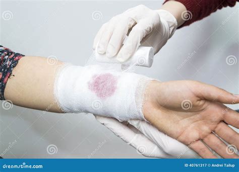 Bandage techniques stock image. Image of medical, health - 40761317