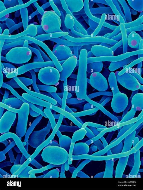 Coloured Scanning Electron Micrograph Sem Of Candida Albicans Yeast