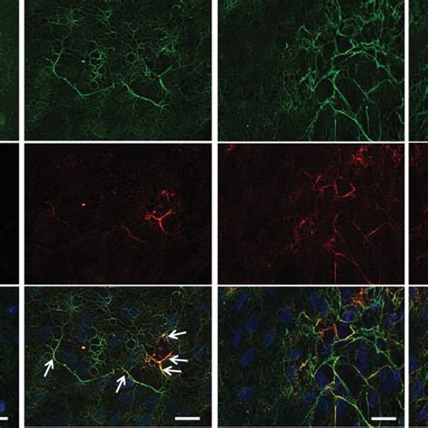 PDF Fibrillin 1 And Fibrillin 2 Are Essential For Formation Of Thick