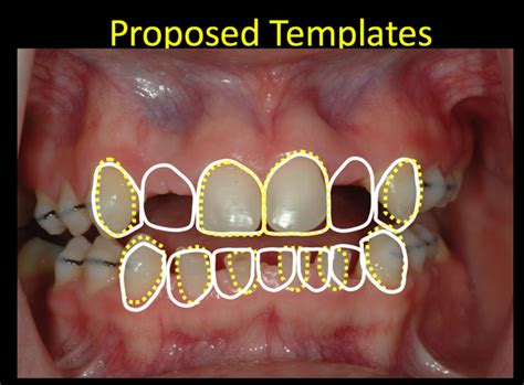 Managing and Treatment Planning For Ogilodontia - Spear Education