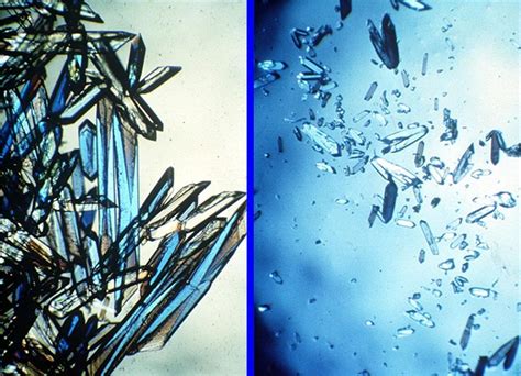 Space May Be The Best Place To Grow Bone Formation Protein Crystals Space