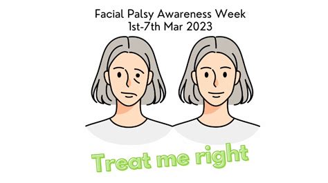 Facial Palsy Treat Me Right Pmc Physiotherapy Dunboyne Chartered Physiotherapists