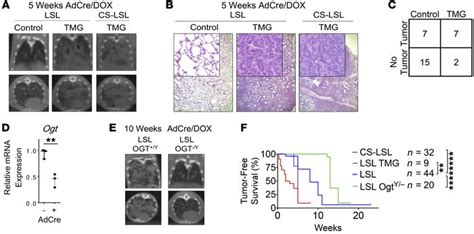 Jci O Glcnacylation Is Required For Mutant Kras Induced Lung