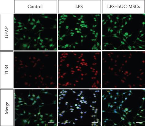 Huc Mscs Modulate Tlr Pathway Related Agents And Proinflammatory