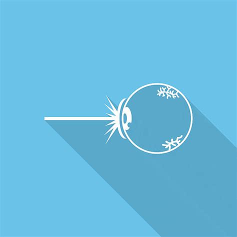 Best Cataract Surgery Illustrations, Royalty-Free Vector Graphics & Clip Art - iStock