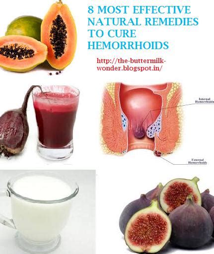 8 Most Effective Natural Remedies To Treat Hemorrhoids With Quick