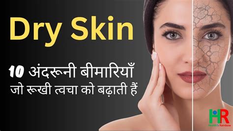 Dry Skin Problems And Treatment शुष्क त्वचा रूखी त्वचा के लिए