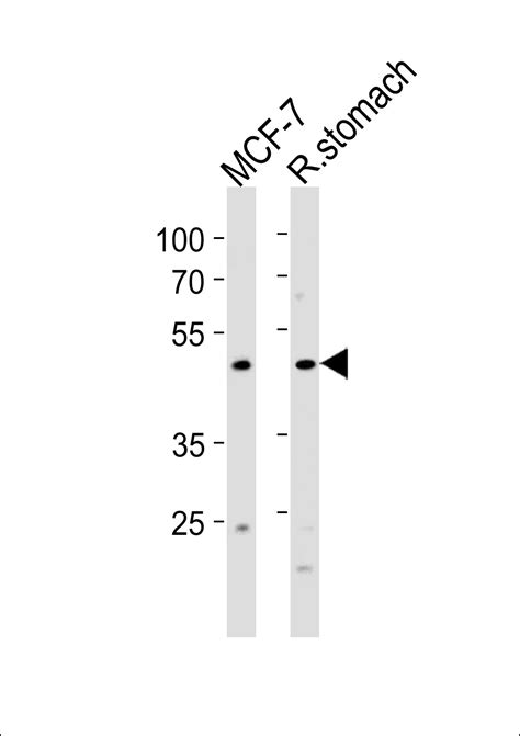 Foxa Antibody C Term Affinity Purified Rabbit Polyclonal Antibody