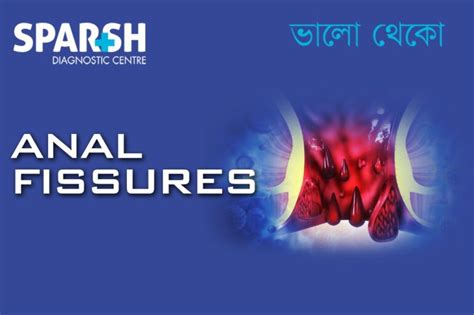 Anal Fissures Sparsh Diagnostic Center