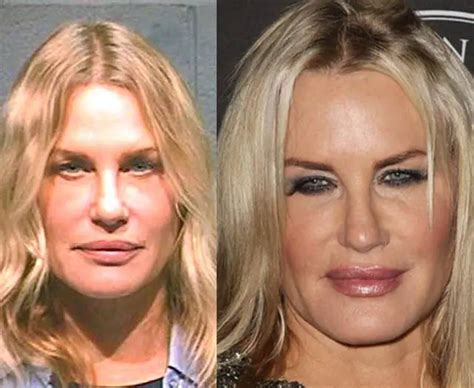 Darrah Hannah Plastic Surgery