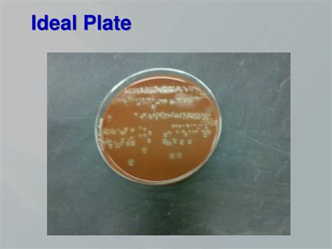 PPT Sex And The Superbug Next Steps In Dealing With Multi Drug Resistant Gonorrhea In