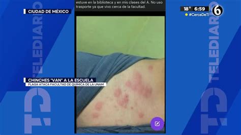 Reportan plaga de chinches en la Facultad de Química de la UNAM