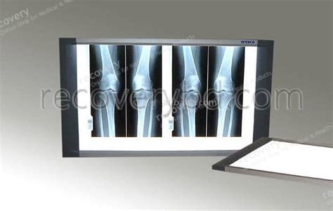 X Ray Film Viewer Led Type Led X Ray View Box