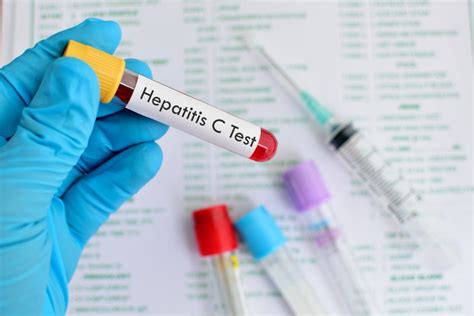 Hepatitis C Penyebab Gejala Diagnosis Dan Pengobatan