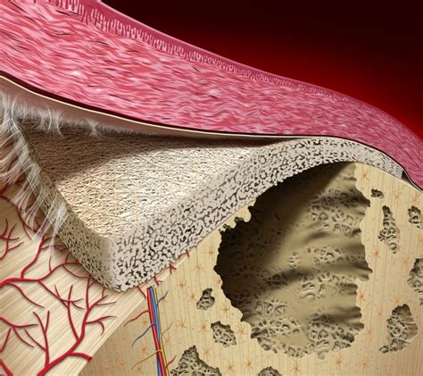 Todo sobre la regeneración ósea y su gran importancia en implantes