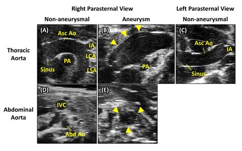 Ultrasound Imaging Of The Thoracic And Abdominal Aorta In Mice To