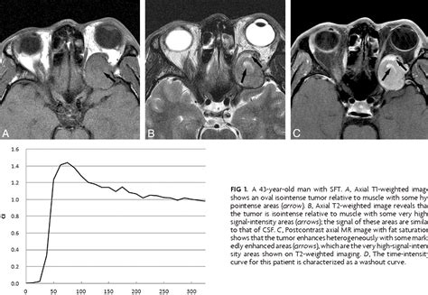 Figure From Value Of Mr Imaging In Differentiation Between Solitary