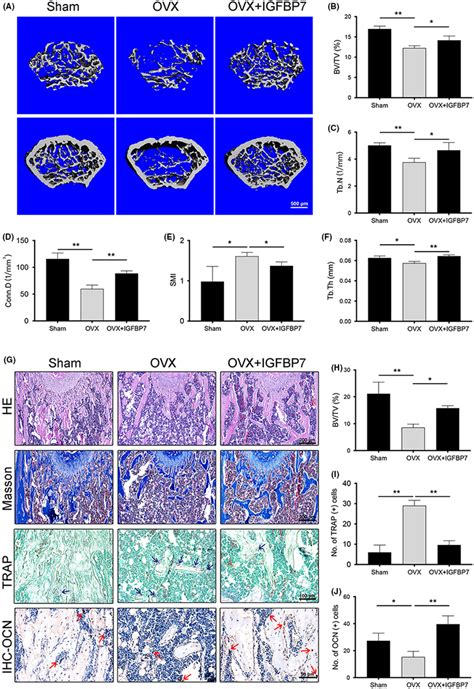 Igfbp Protected Against Ovxinduced Bone Loss In Vivo A