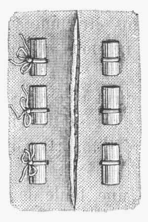 Types Of Stitches Used In Sutures, From Dictionnaire - Types Of Sutures ...