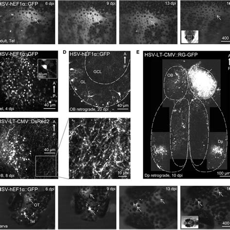 Gene Expression In The Adult Zebrafish Brain Using Electroporation A