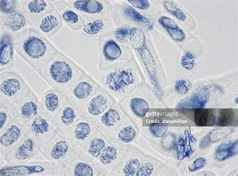 Microscope Image Of Plant Cells Stained For Nuclei And Chromosomes High