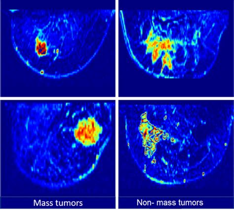 Examples Of Dynamic Contrast Enhanced Dce Mri Slices With Color Map