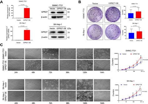 Overexpression Of Gpr Promotes Hcc Cells Proliferation In Vitro A