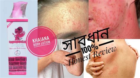 মাত্র ৭ দিনে ত্বক ধবধবে ফর্সা Khazana Body Whitening Lotion Review