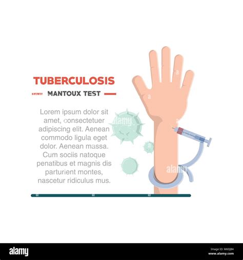 Tuberculosis Infographic Design With Hand With Mantoux Test Over White Background Colorful