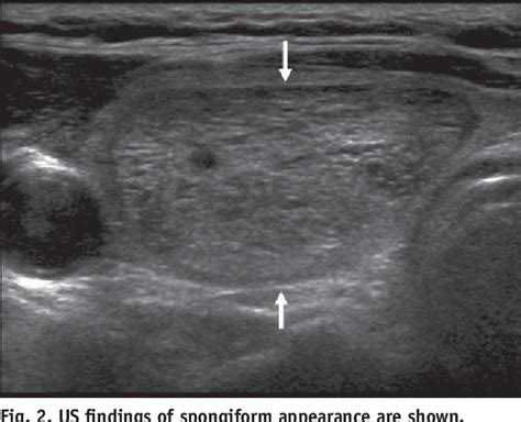 Figure 5 From Ultrasonography And The Ultrasound Based Management Of Thyroid Nodules Consensus