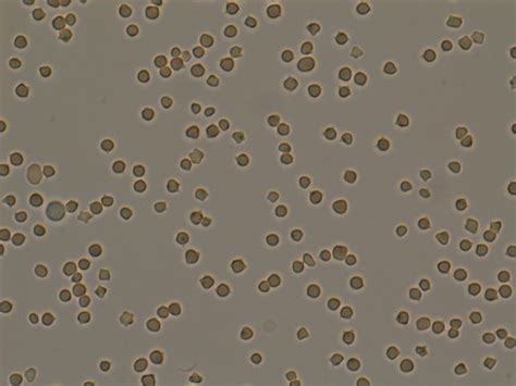 whats  deal   saline agglutination test