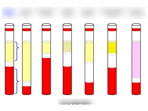 Diagram Of Hematocrit Machine Measuring Hematocrit Diagram