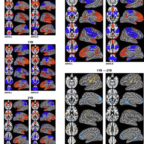 Regional Functional Connectivity And Corresponding Longitudinal Changes