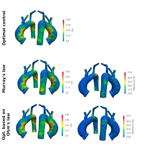 Left Oscillatory Shear Index Osi Results Obtained With The Three