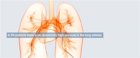 Pulmonary Hypertension Knowledge Sharing Platform