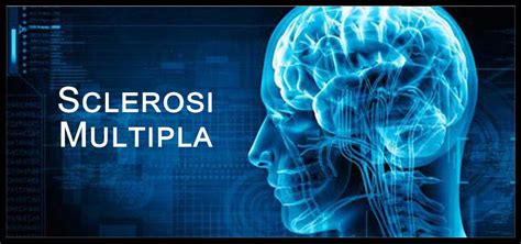 Sclerosi Multipla Sintomi Iniziali Cause Terapie Aspettative Di