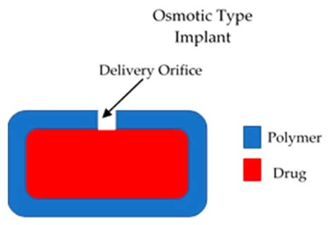 Polymers Free Full Text Implantable Polymeric Drug Delivery Devices