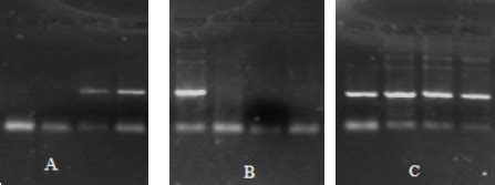 Agarose Gel Electrophoresis Showing Deletion Of Gstm And Gstt Genes