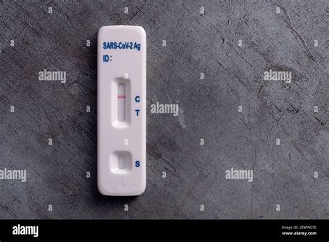 Resultado De La Prueba De Flujo Lateral Fotograf As E Im Genes De Alta