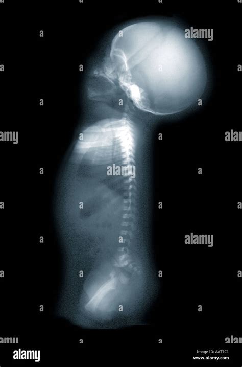 Disturbo congenito fotografías e imágenes de alta resolución Alamy