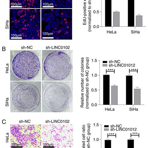 LINC01012 Knockdown Suppresses The Proliferation And Migration Of