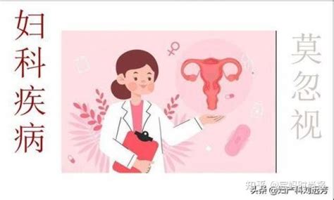 外阴瘙痒用什么药物治疗比较好女性下面发炎用什么药 知乎