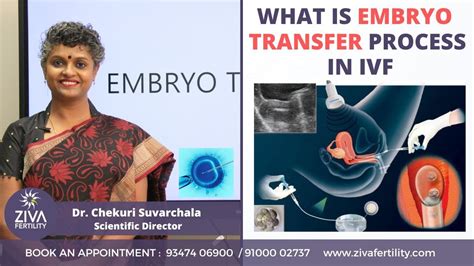 Embryo Transfer Process Ivf Dr C Suvarchalaa Ziva Fertilityy